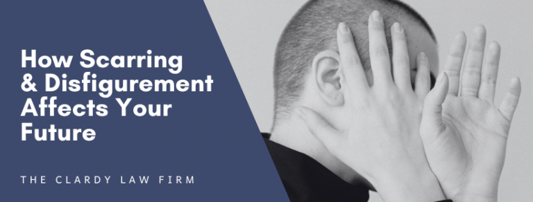 blog cover image displays a person covering their face with their hands with a title of "How Scarring and Disfigurement Affects Your Future"