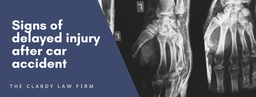 Signs of delayed injury after car accident