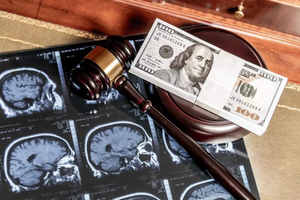 Gavel, hundred-dollar bills, and brain MRI scans symbolizing a personal injury settlement.